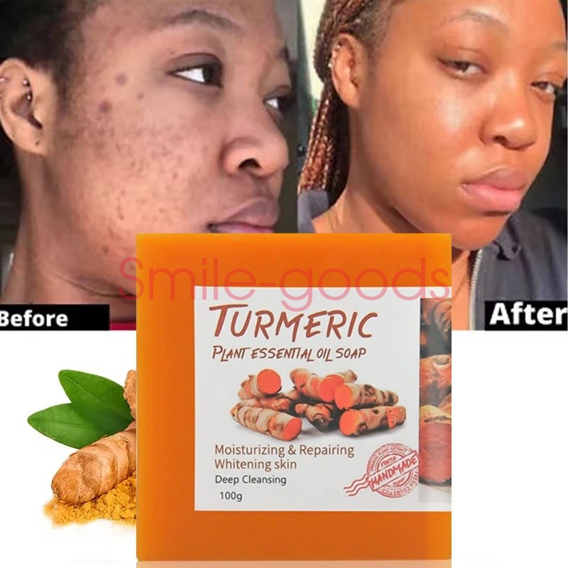 Turmeric Soap for Whitening & Acne Treatment - Natural Brightening 100g