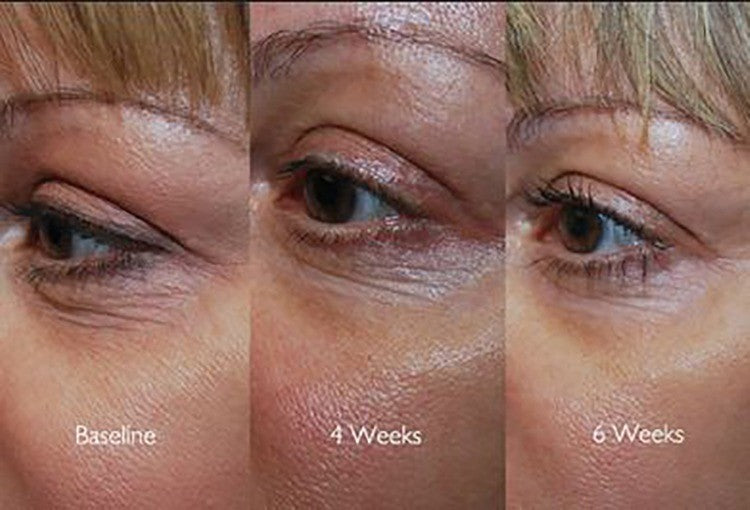 ProCare Facial Serum Anti-Aging Wrinkle Defense with CoQ10 & Hyaluronic Acid