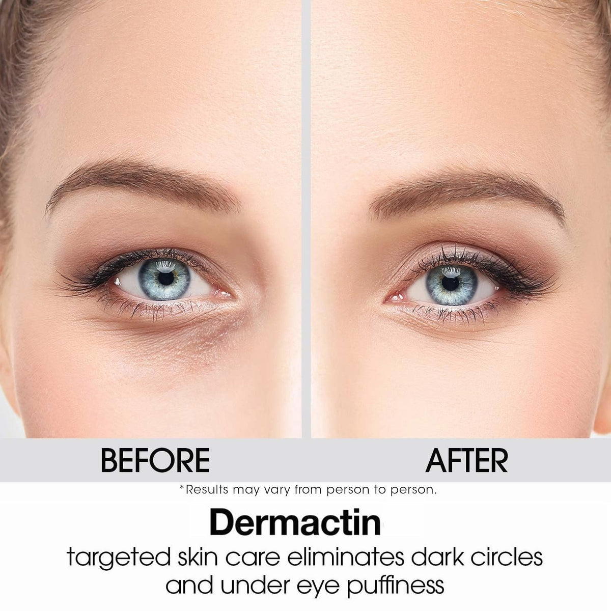 Eyelid Firming Cream for Sagging Skin - 1 oz. Eye Lift & Anti-Aging