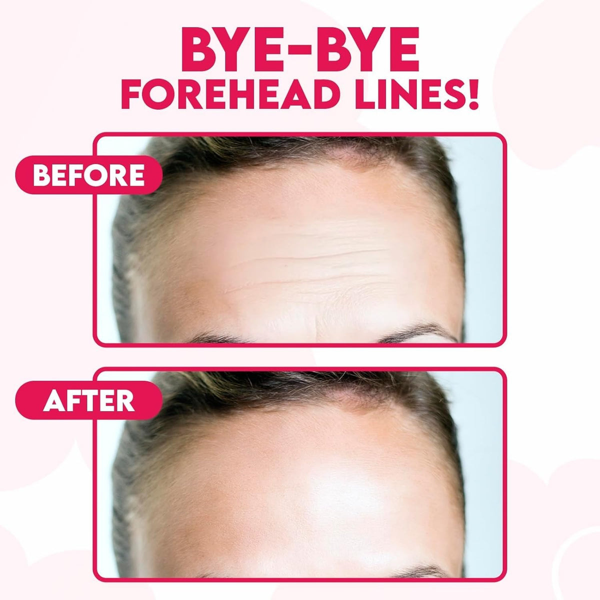Forehead Wrinkle Patches with Hyaluronic Acid & Peptides (16pcs)