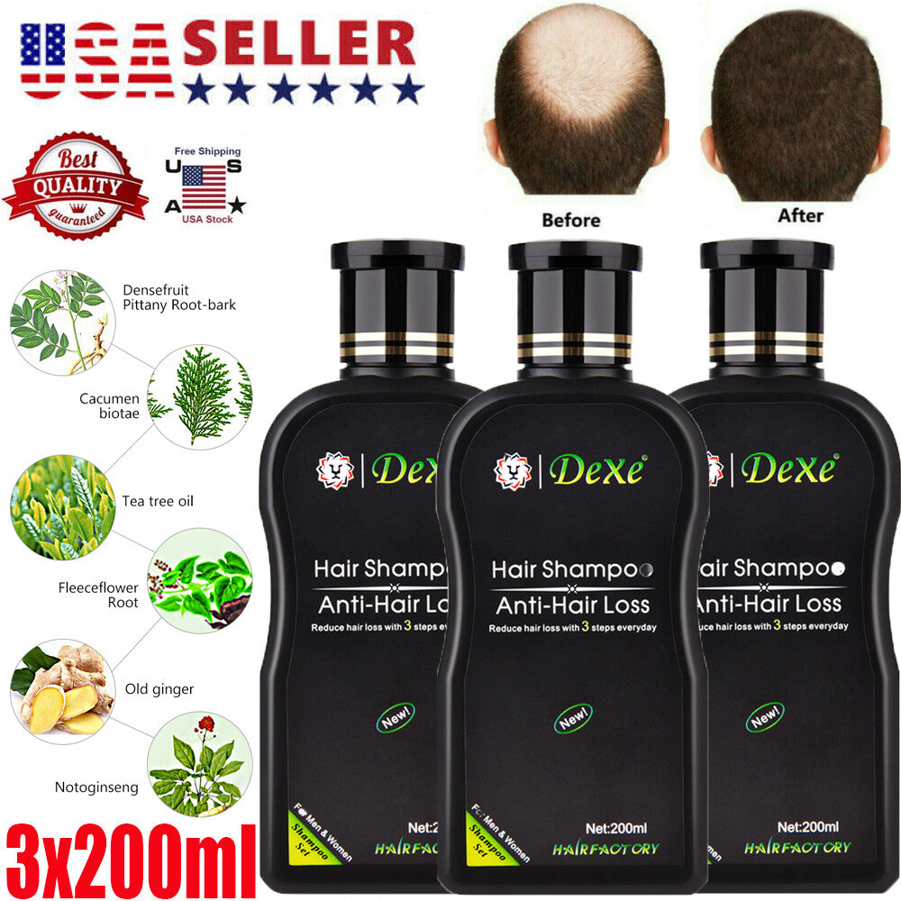 Anti Hair Loss Shampoo - 3Pc Set, 200ml Bottles