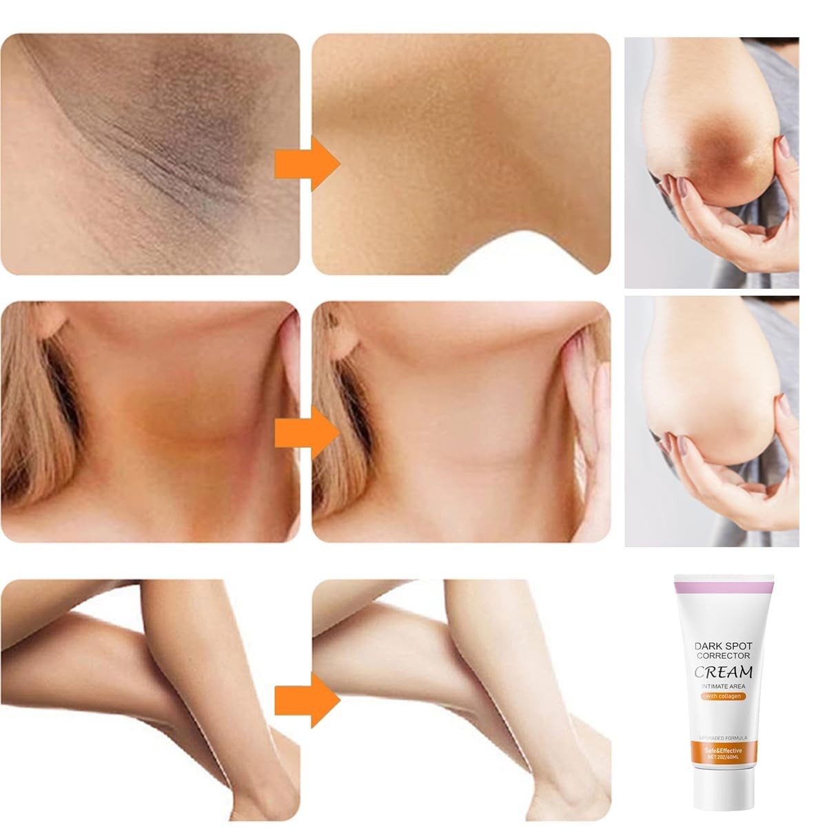 Dark Spot Remover Cream for Face & Body - Brightening Hyperpigmentation Treatment