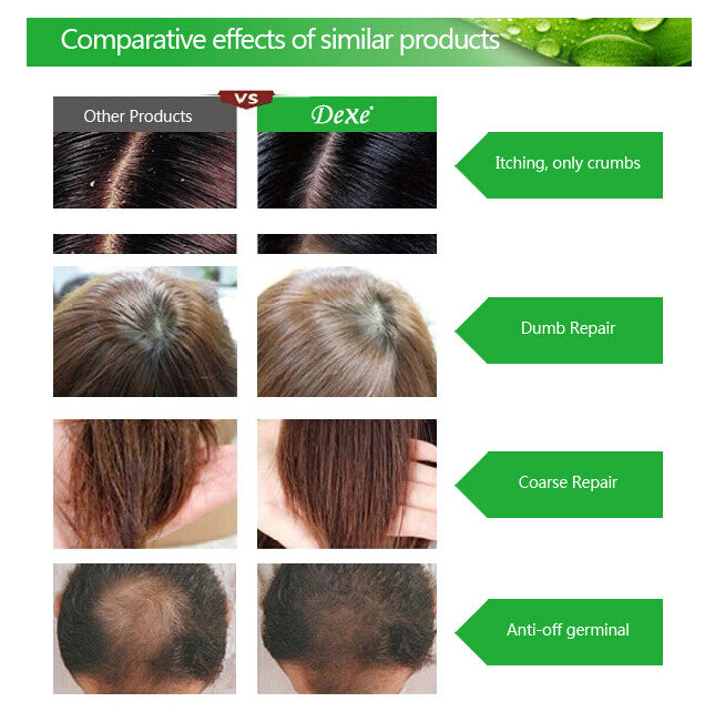 Anti-Hair Loss Shampoo for Men & Women - 200ml