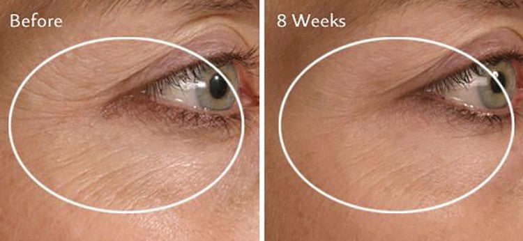 ProCare Facial Serum Anti-Aging Wrinkle Defense with CoQ10 & Hyaluronic Acid