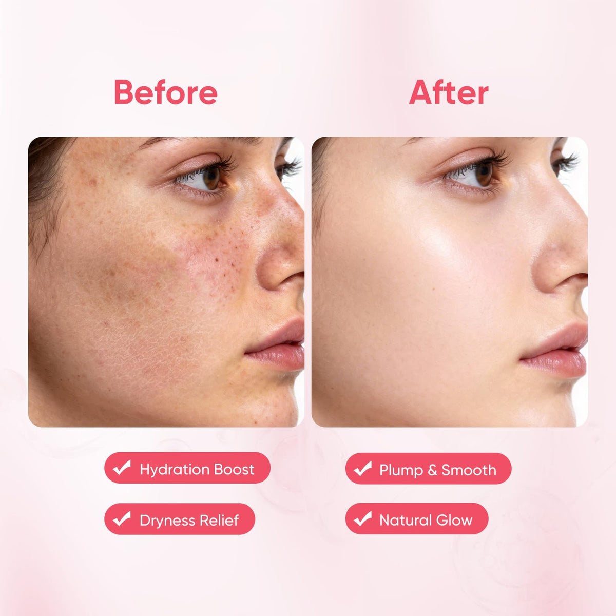 Hydrating Collagen Face Masks Pack of 10 for Deep Moisturization
