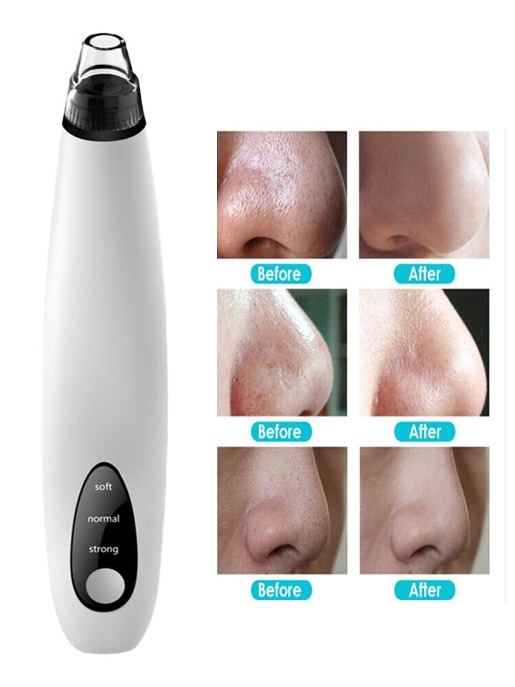 Electric Blackhead Remover Vacuum Facial Pore Cleaner with Adjustable Suction