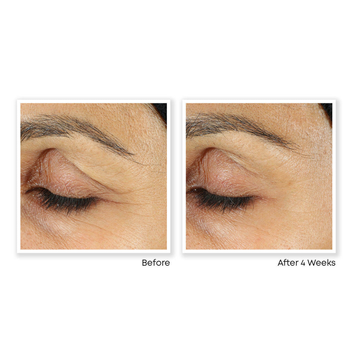 Anti-Aging Retinol Vitamin A Serum for Face - Fine Lines & Wrinkles Treatment