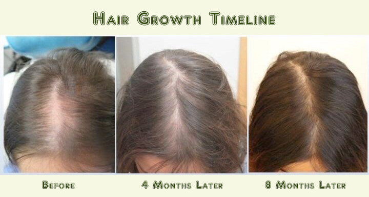 Hair Loss Conditioner - 16 Organic Oils for Men & Women