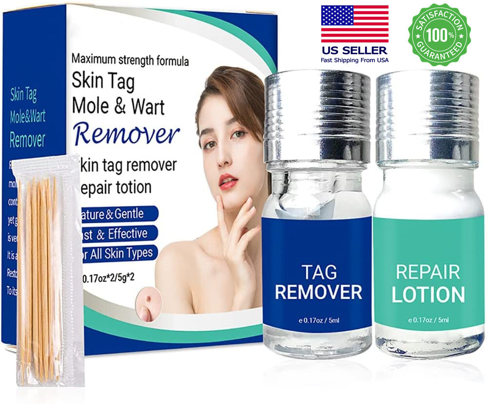 Skin Tag Remover Liquid for Mole & Wart Removal - Safe & Fast Treatment
