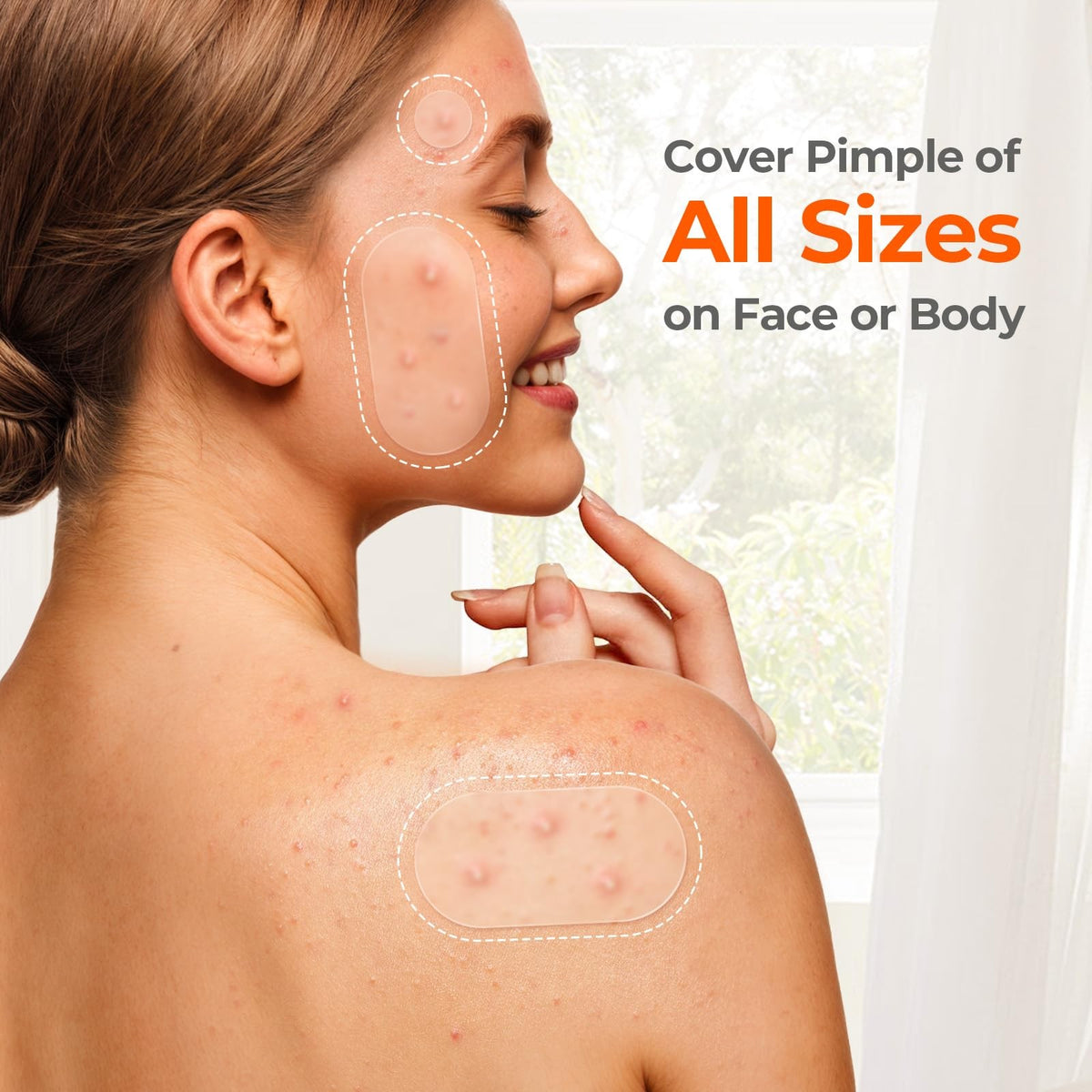 Hydrocolloid Acne Patches, 443 Count Variety Pack - 5 Sizes