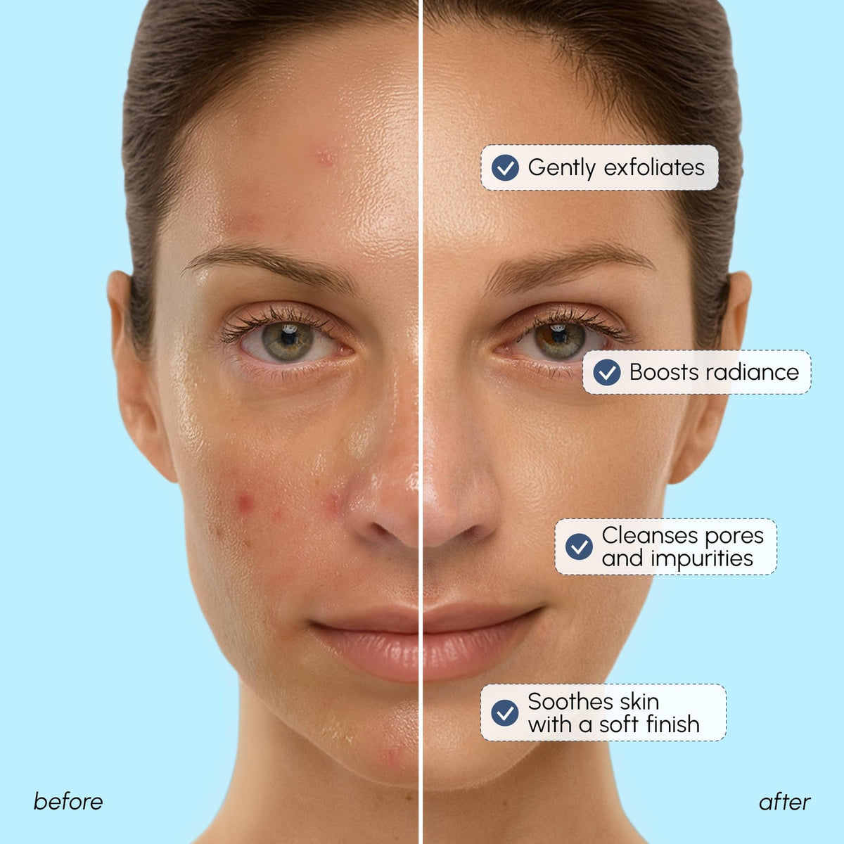 MAREE Face Exfoliator — Microdermabrasion Facial Scrub Exfoliating