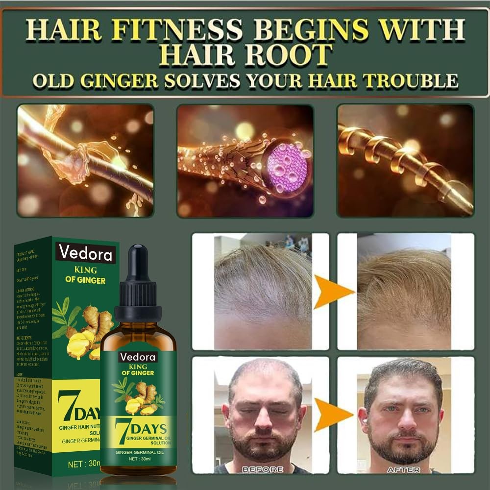 Hair Growth Serum with Ginger Oil and Biotin for Thinning Hair - Natural & Fast Results