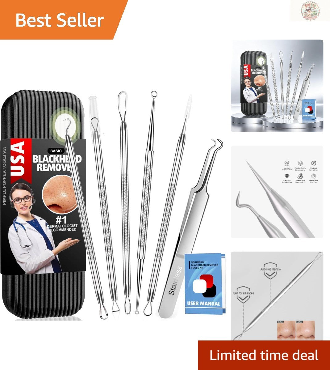 6-Piece Stainless Steel Blackhead Remover Kit - Ergonomic & Durable