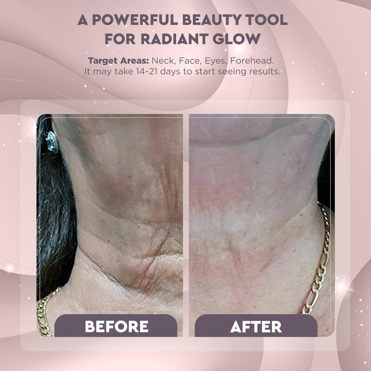 Red Light Therapy Device for Face and Neck - Skin Rejuvenation