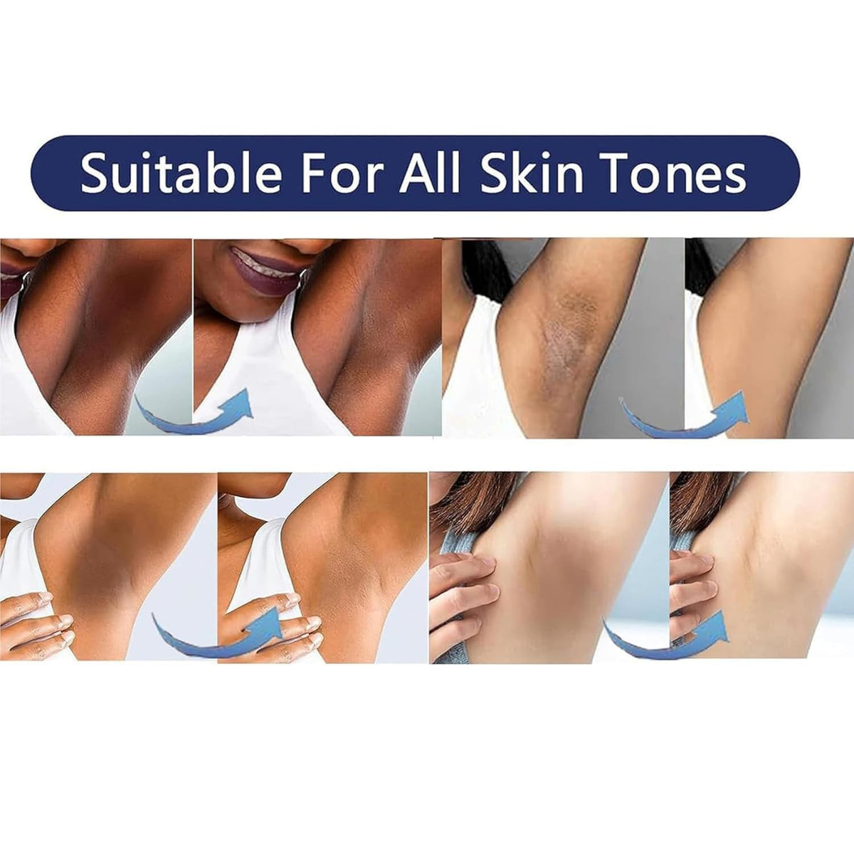 Skin Lightening Gel for Body & Intimate Areas with Niacinamide & Arbutin