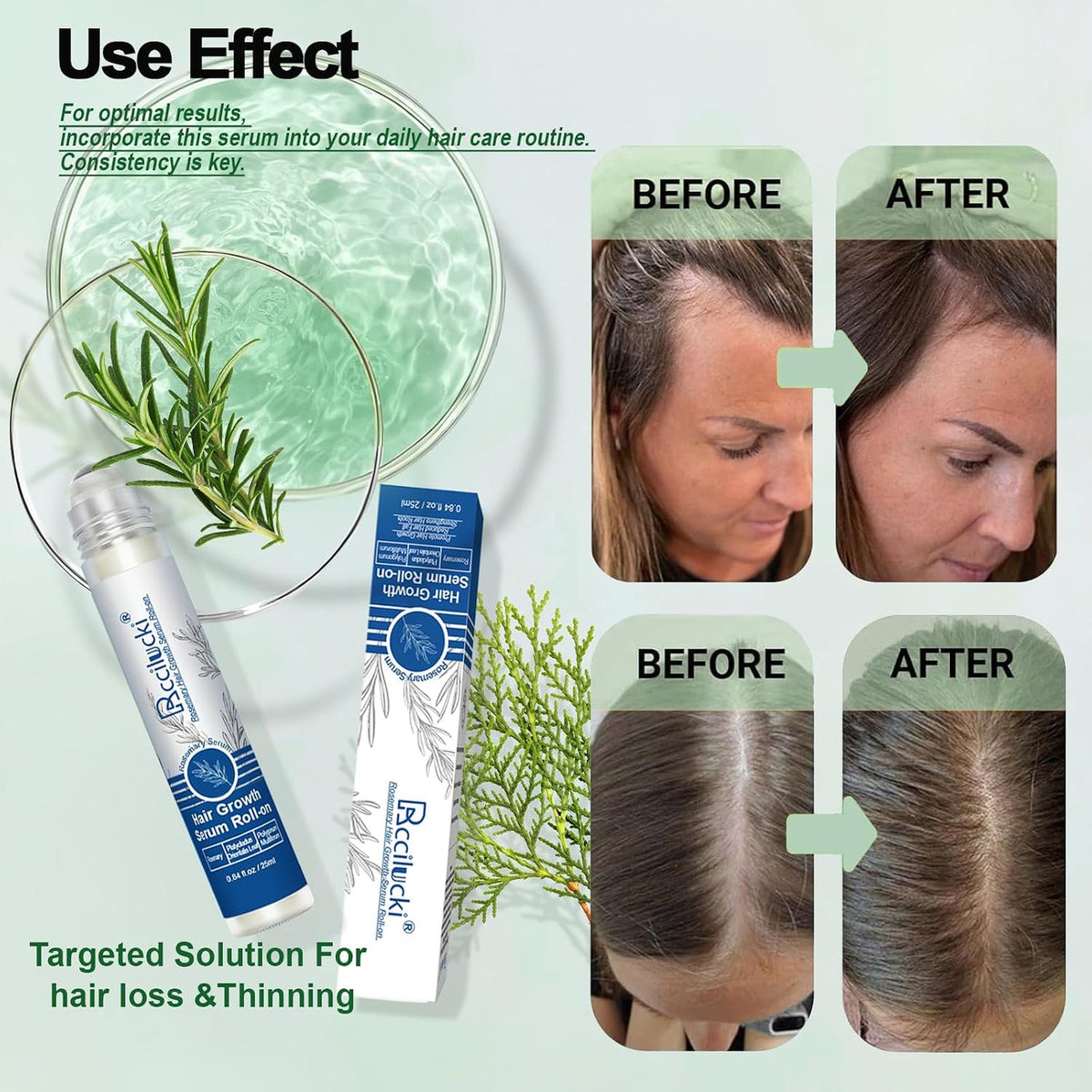 Rosemary Hair Growth Serum Roll-On 25ml – 2 Pack