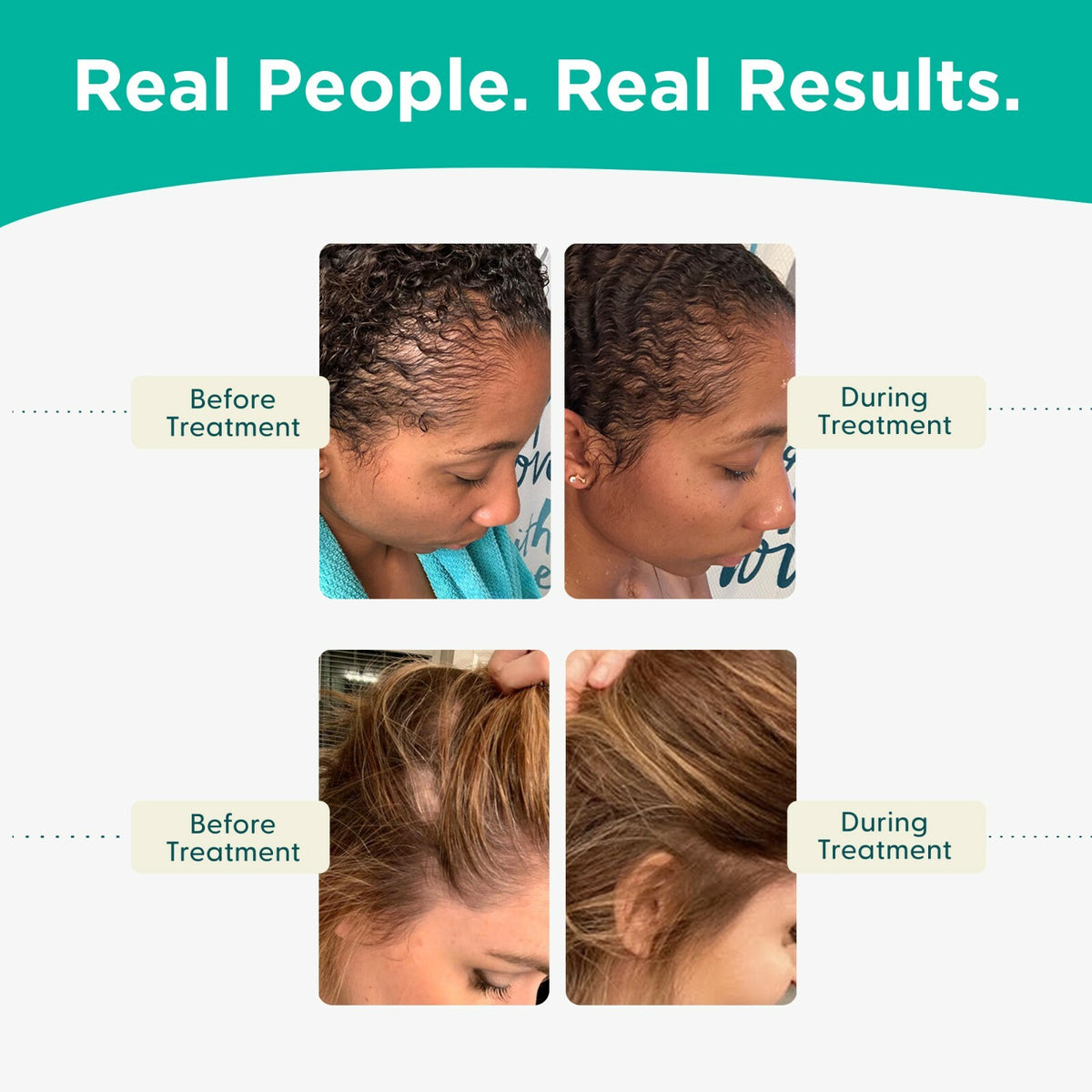 Hair Loss Shampoo and Conditioner with DHT Blockers