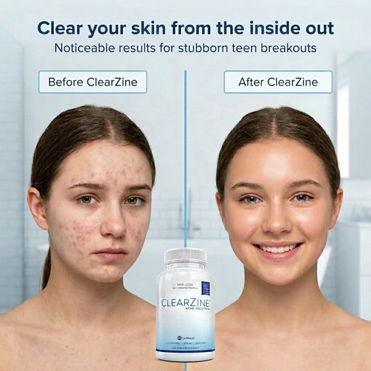Acne Treatment Pills - Clear Skin Vitamins for Teens & Adults