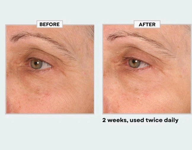 Black Rice Face Cream - Anti-Aging Moisturizer with Peptides & Antioxidants, 6.7 fl oz