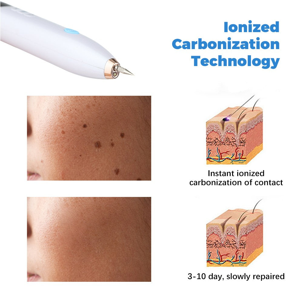 Laser Mole & Skin Spot Remover Pen - Dark Spot, Wart, Tattoo, Freckle Treatment