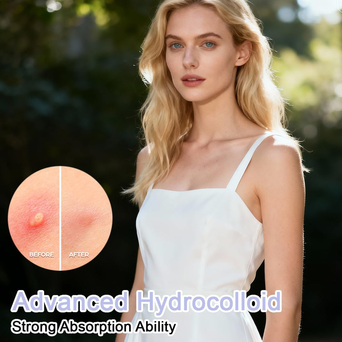 Large Hydrocolloid Chin Zit Patches - 20 Count Contoured Blemish Cover