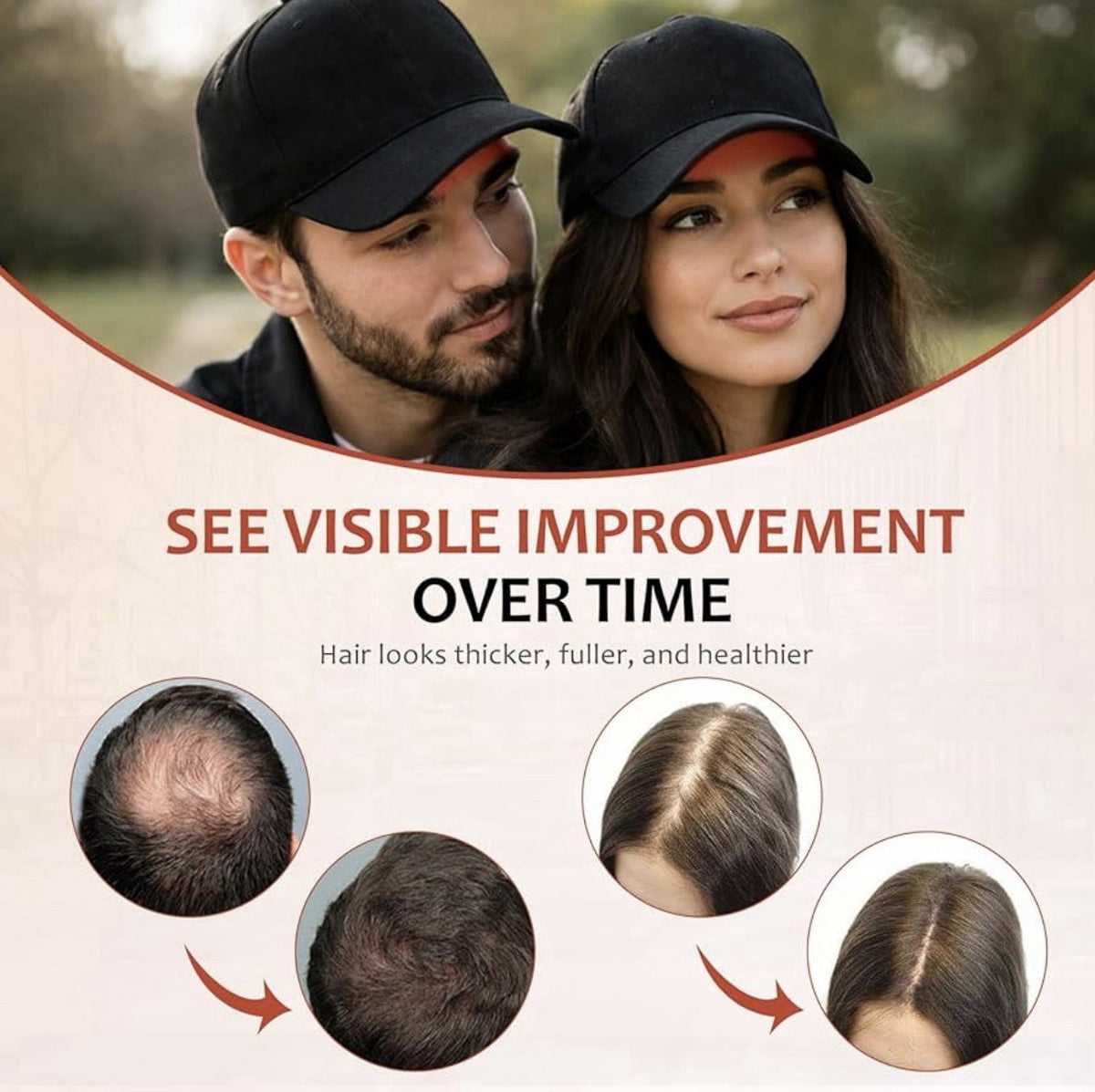 Red Light Therapy Hair Growth Cap - LED Hat for Men & Women