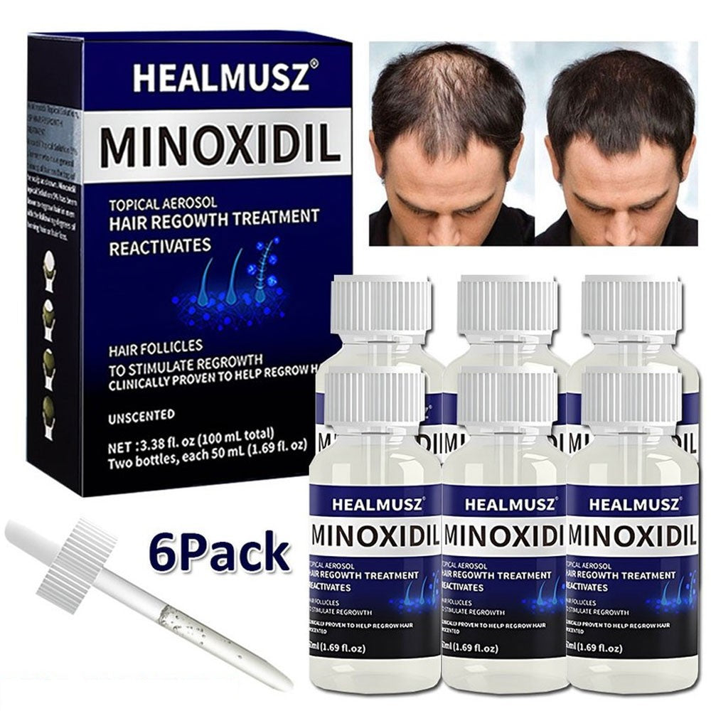 5% Minoxidil Hair Regrowth Treatment for Men - 6 Pack