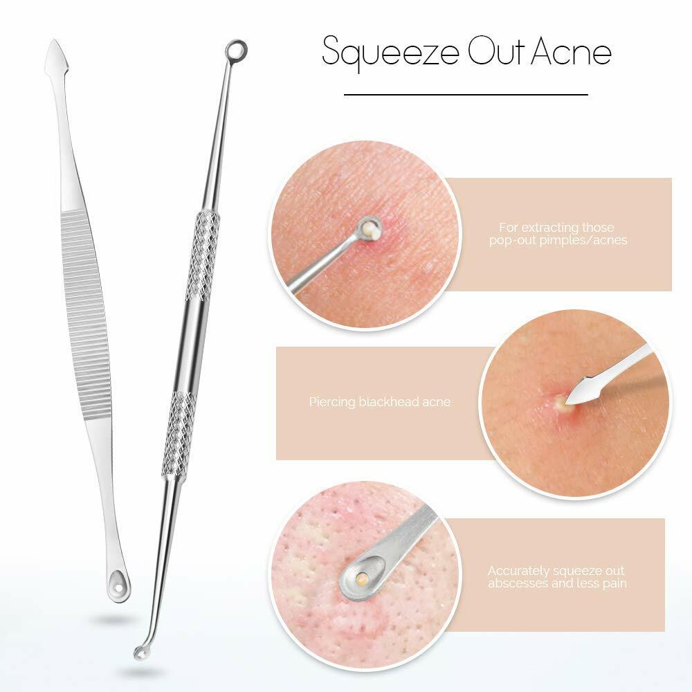 Pimple Popper & Blackhead Extractor Tool Kit for Face & Nose Skin Care