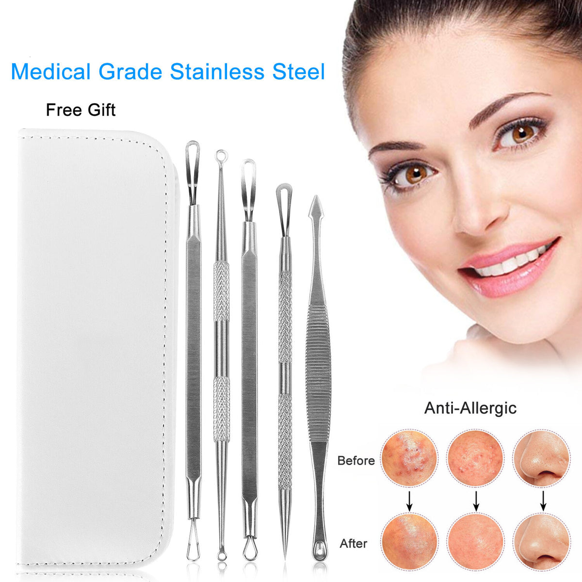Blackhead Remover Kit 5 Pcs Facial Pimple Extractor Tools Set