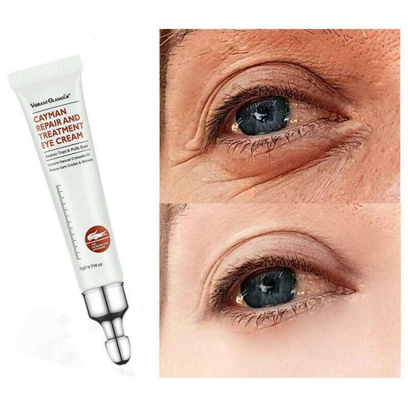 Collagen Retinol Eye Cream for Dark Circles & Wrinkles - 20g
