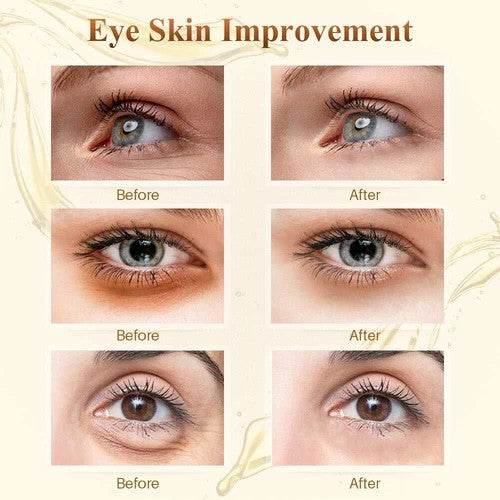Gold Collagen Eye Masks 100 Pairs - Anti-Aging Dark Circles Puffy Eyes
