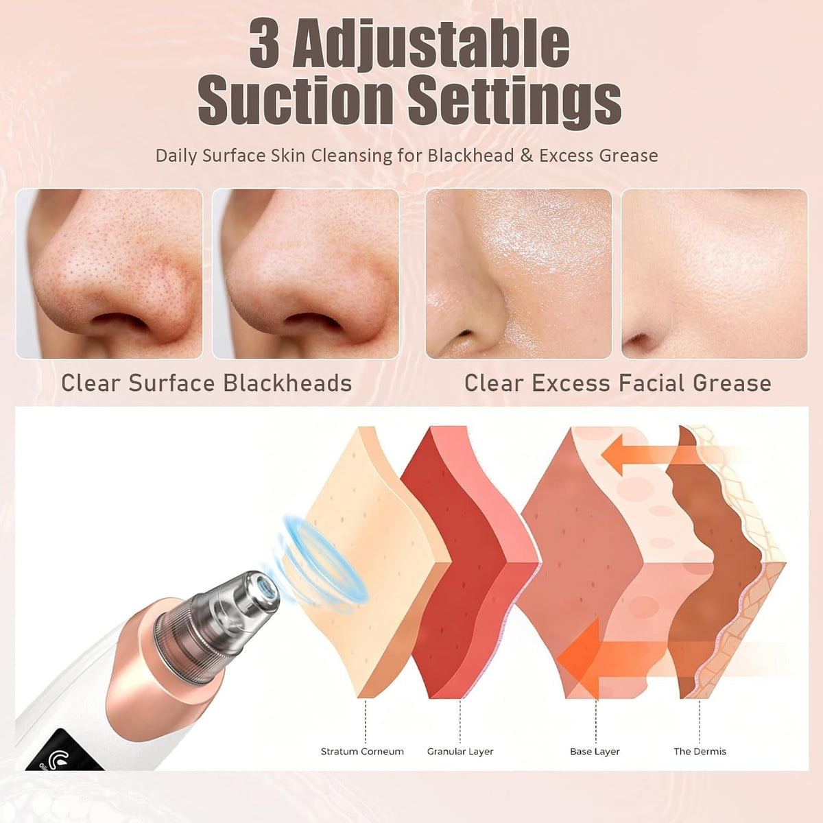 Gold Blackhead Remover Pore Vacuum Cleaner with 5 Suction Power Probes - Facial Skin Care Device