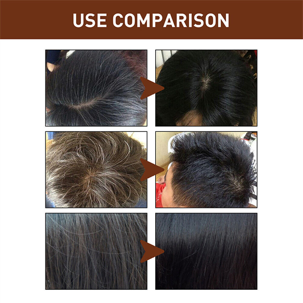 Natural Hair Darkening Shampoo Bar for Gray & Thinning Hair – Organic & Repair
