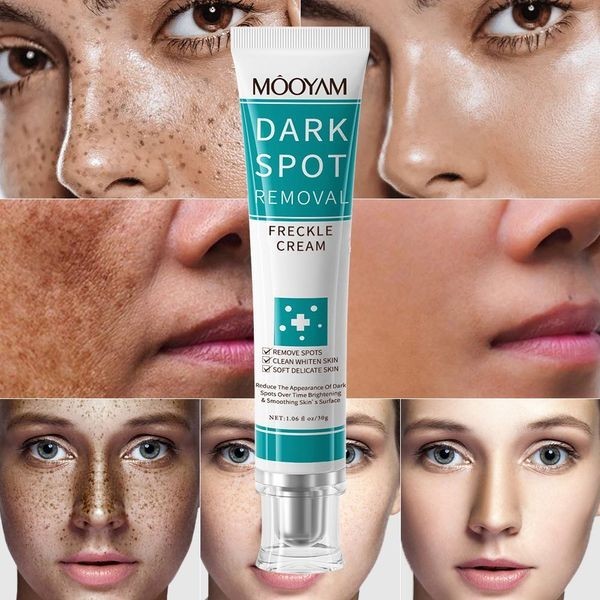 Dark Spot Remover Cream for Face & Body - Anti-Aging & Hyperpigmentation Treatment - 2 Pack