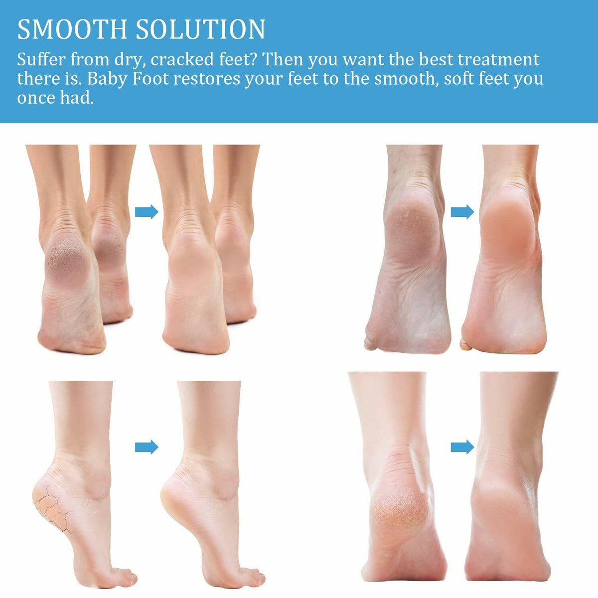 Foot Peeling Mask - 2 Pair Exfoliating Foot Peel