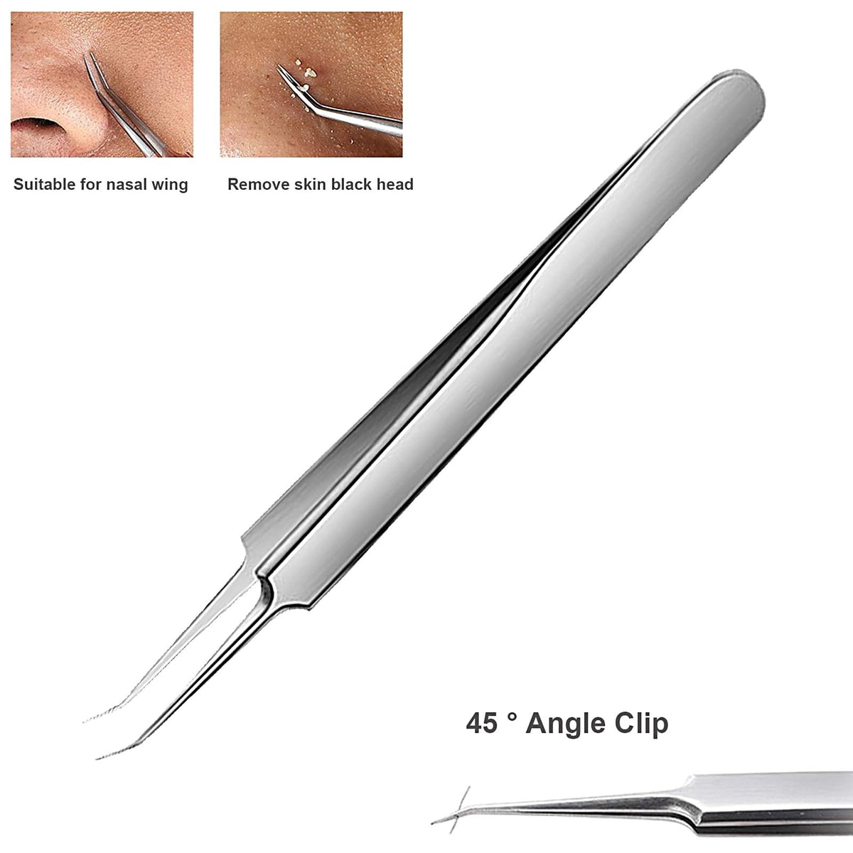 Blackhead Tweezers Set - 3 Stainless Steel Comedone Extractors for Acne & Pores