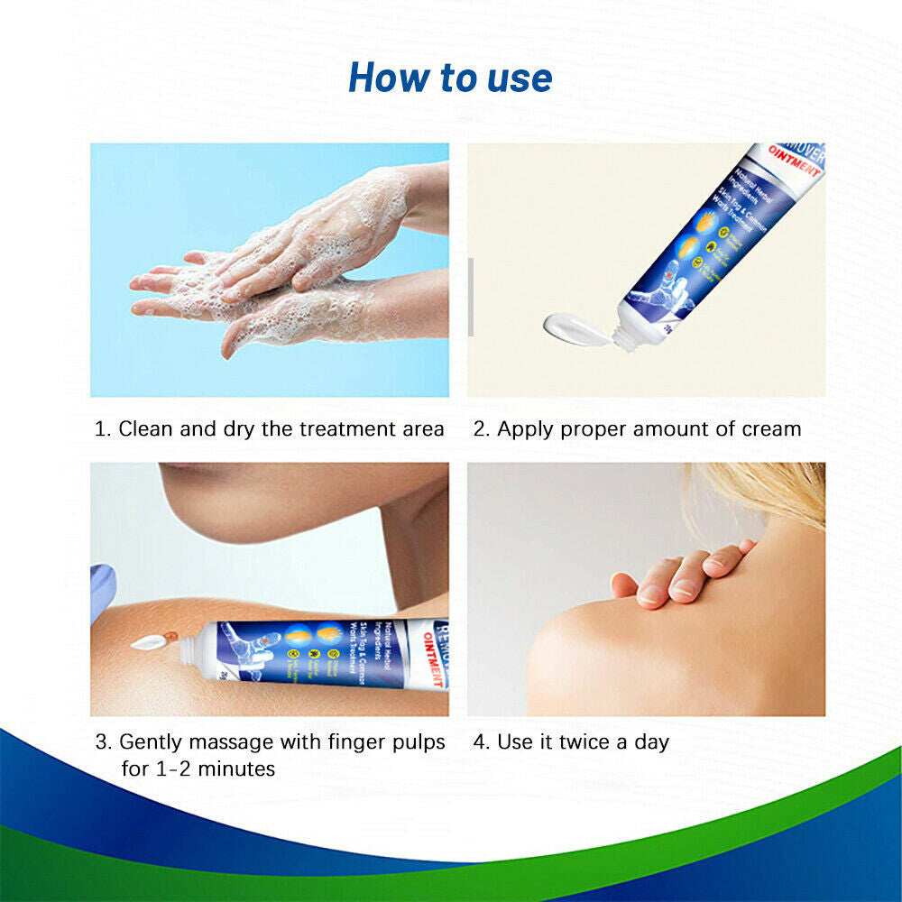 Wart & Skin Tag Remover Pen - Painless, Pimple & Mole Removal Device