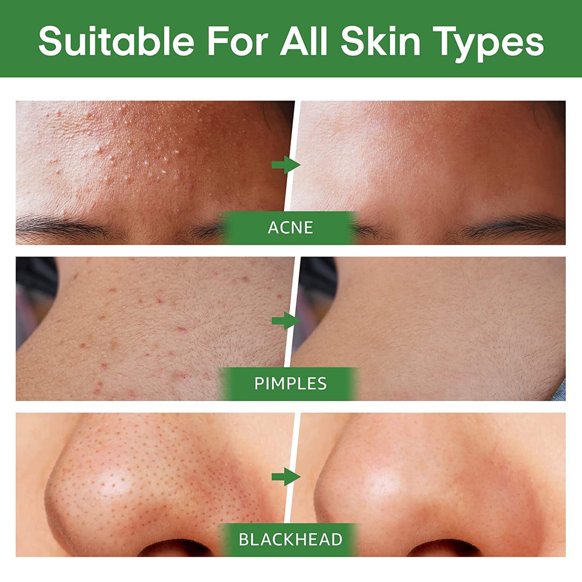 Green Tea Purifying Clay Stick Mask for Blackhead Removal