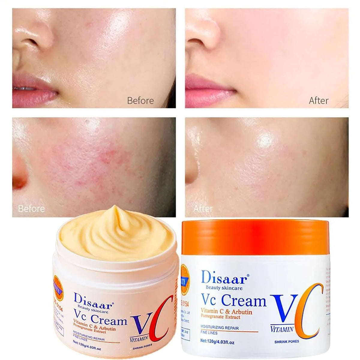 DISAAR Beauty Moisturizing Cream Vitamin C Arbutin Pomegranate