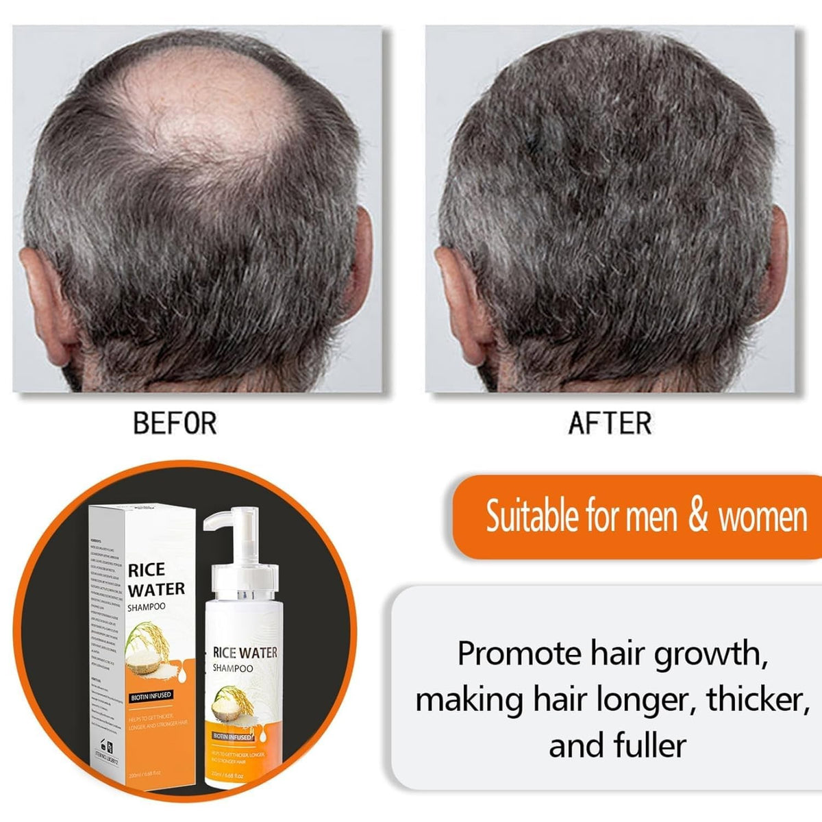 Rice Water Hair Growth Shampoo – Anti-Shedding, 2 x 3.38 fl. oz