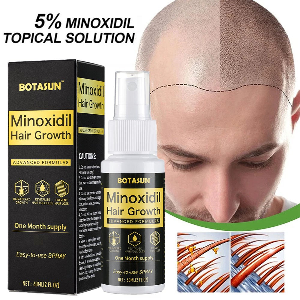 Minoxidil 5% Spray for Men Hair Regrowth Treatment