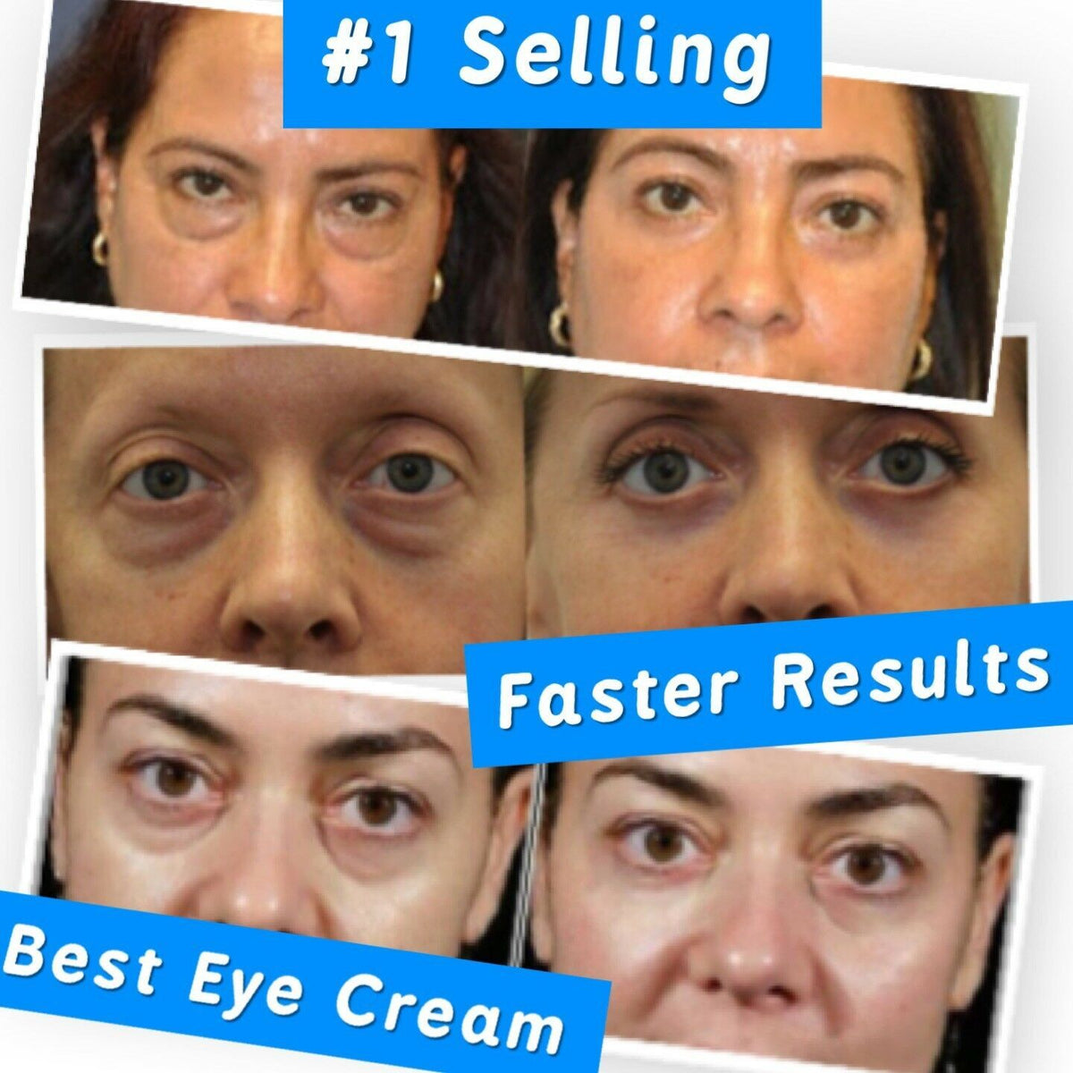 Collagen Retinol Eye Cream for Dark Circles & Wrinkles - 20g