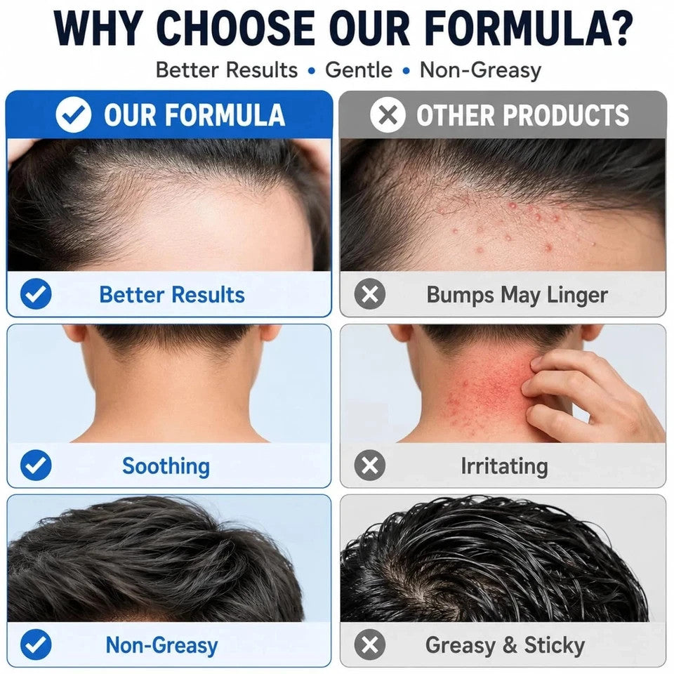 Folliculitis Treatment Cream with Benzoyl Peroxide & Tea Tree Oil - 100g
