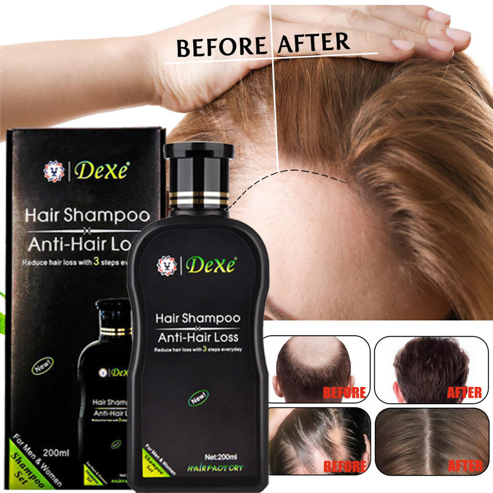 Anti-Hair Loss Shampoo for Hair Growth & Thickening - 200ml