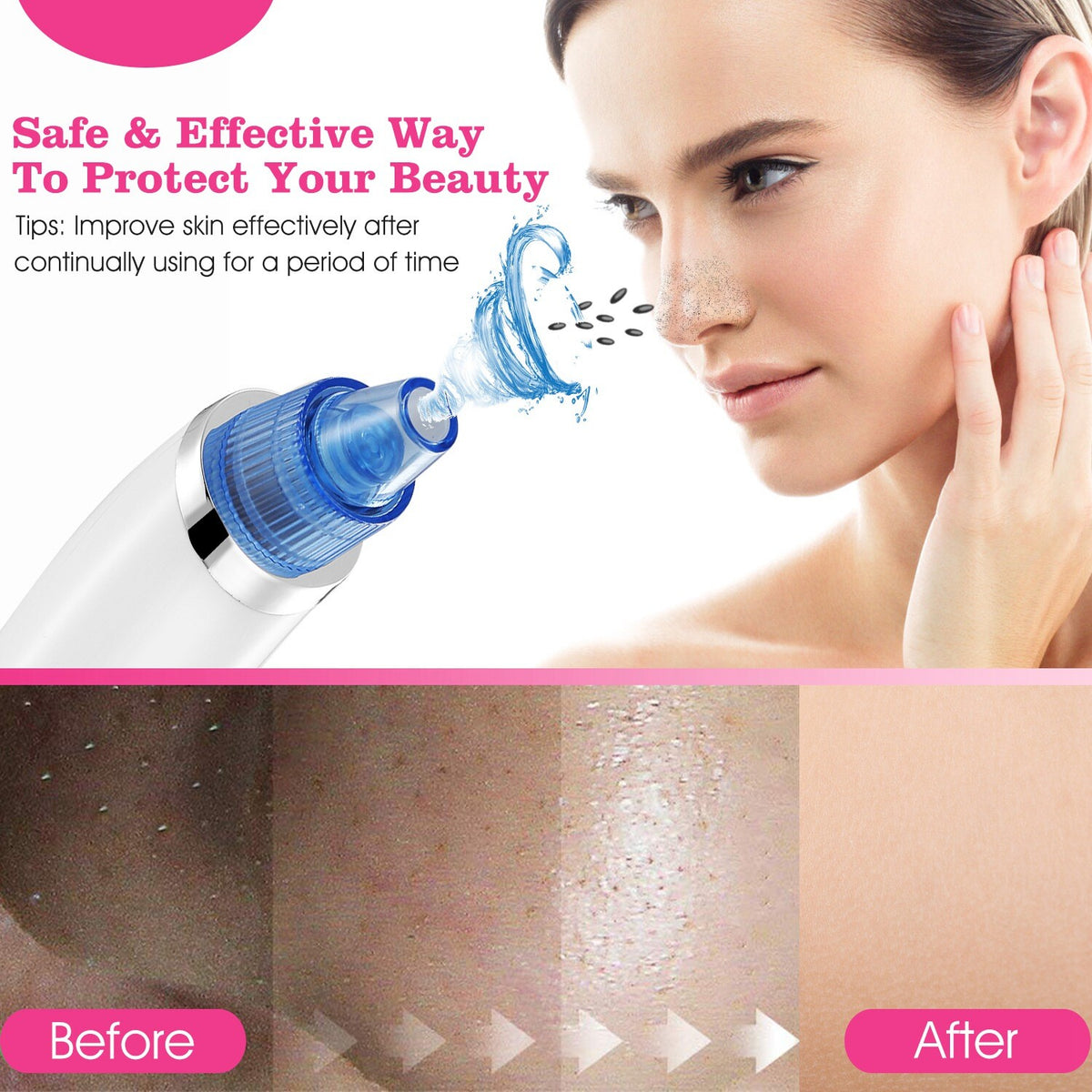 Electric Blackhead Remover Vacuum Pore Extractor with 4 Probes - USB Rechargeable