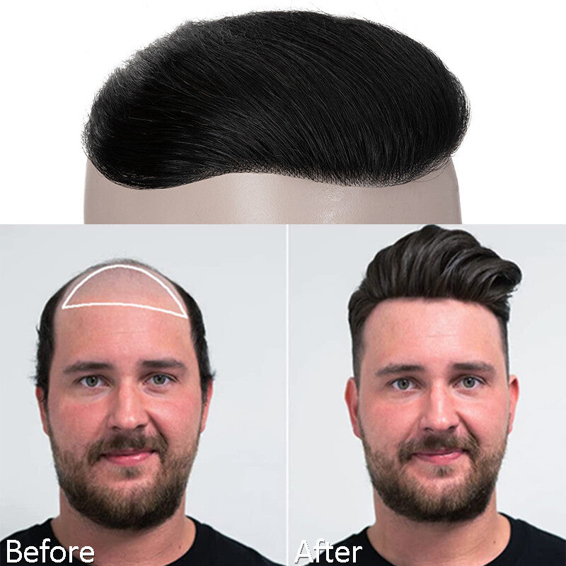 Men's Receding Hairline Toupee with Human Hair & Skin PU Base
