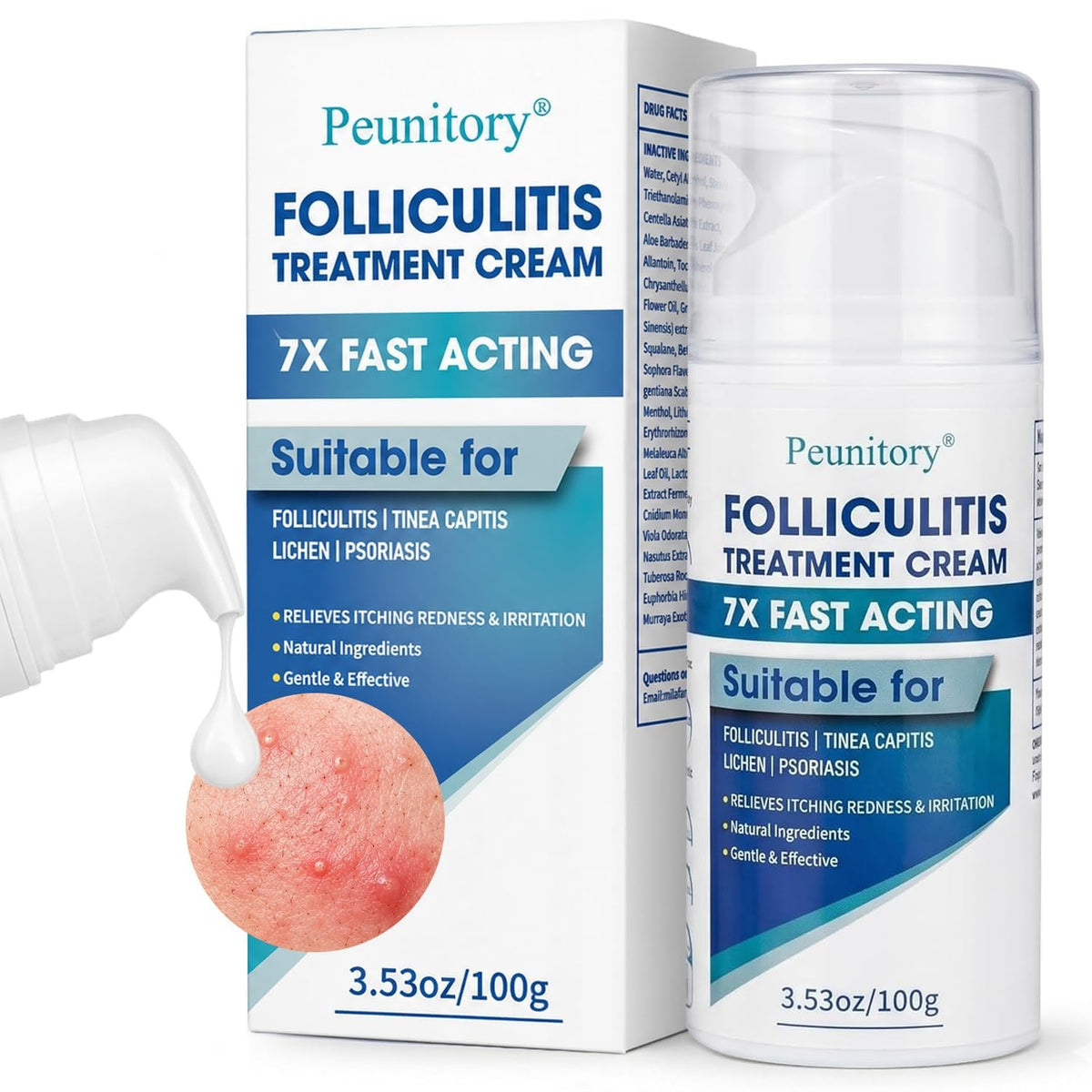 Folliculitis Treatment Cream with Benzoyl Peroxide & Tea Tree Oil - 3.53 oz