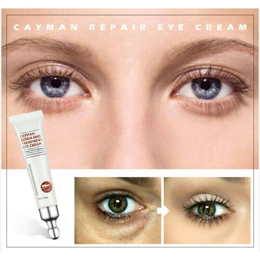 Anti-Aging Eye Cream Gel for Dark Circles & Bags - Brightening & Firming