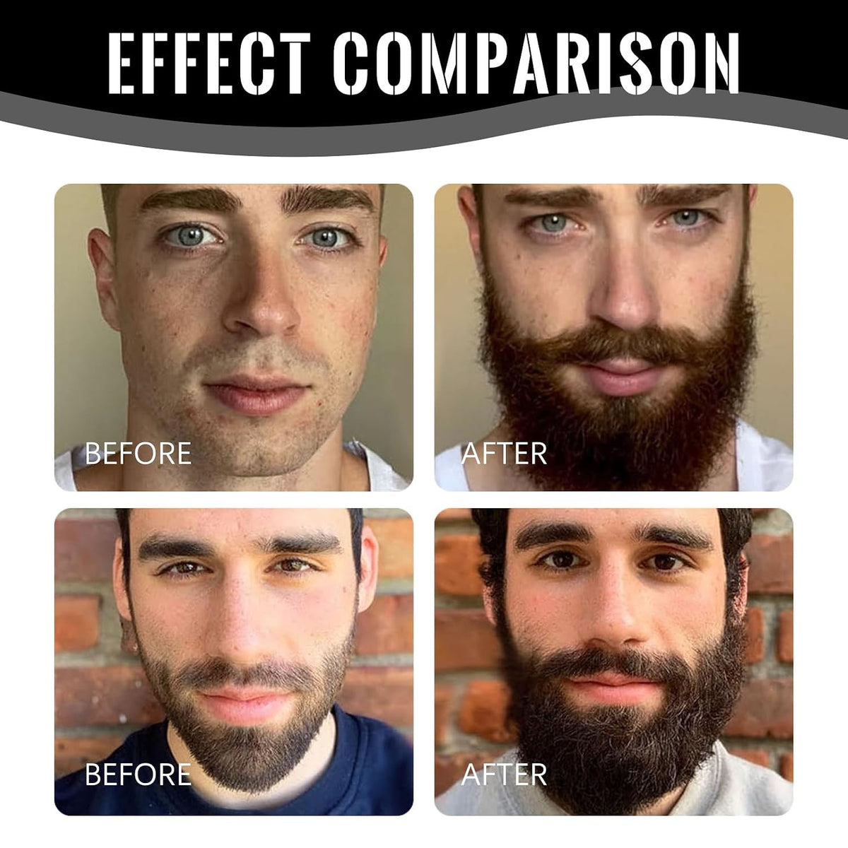 Men's Beard Growth Stimulator - Fuller, Thicker Beard Support
