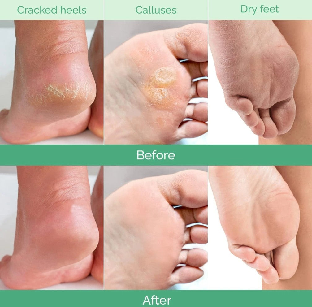 Foot Peeling Mask 2 Pack | Heel Repair & Dead Skin Remover